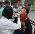 上排大門牙是最容易蛀牙的地方